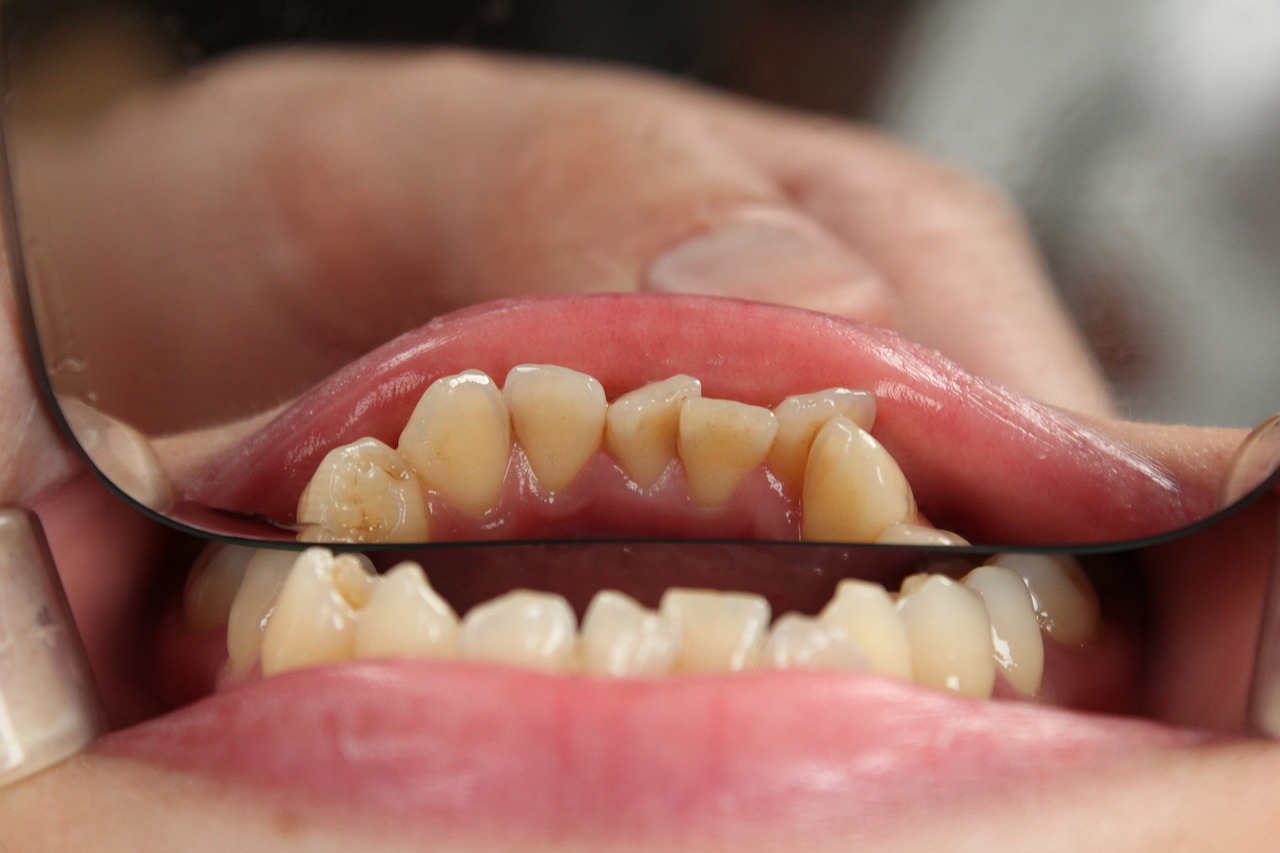 křivé zuby